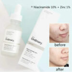 ضد جوش نیاسینامید ۱۰ + زینک %1% اوردینری اصل